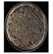 Human infected bone control